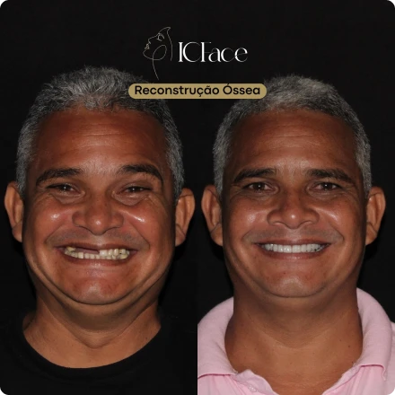 Cirurgias da Face - ICFace Pernambuco