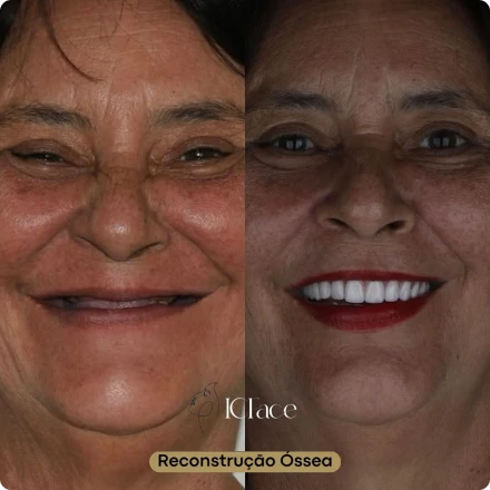 Cirurgias da Face - ICFace Pernambuco