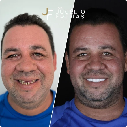 Cirurgias da Face - ICFace Pernambuco