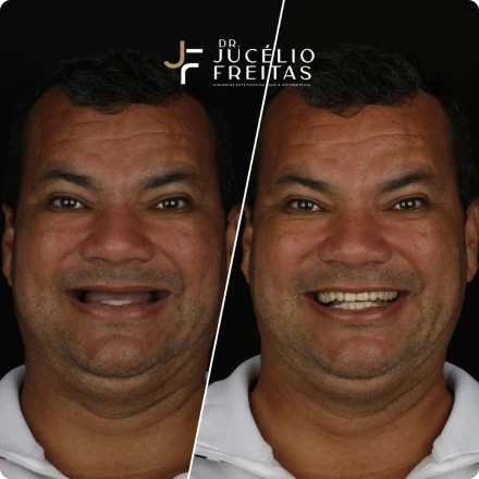 Cirurgias da Face - ICFace Pernambuco