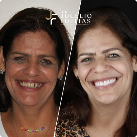 Cirurgias da Face - ICFace Pernambuco