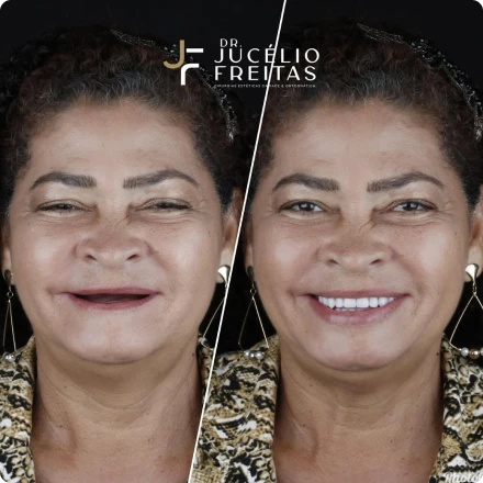 Cirurgias da Face - ICFace Pernambuco