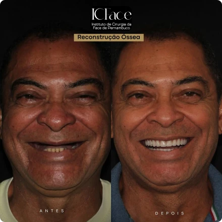 Cirurgias da Face - ICFace Pernambuco