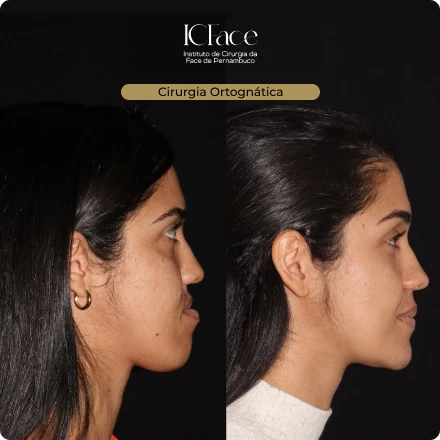 Cirurgias da Face - ICFace Pernambuco