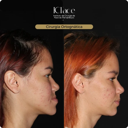 Cirurgias da Face - ICFace Pernambuco